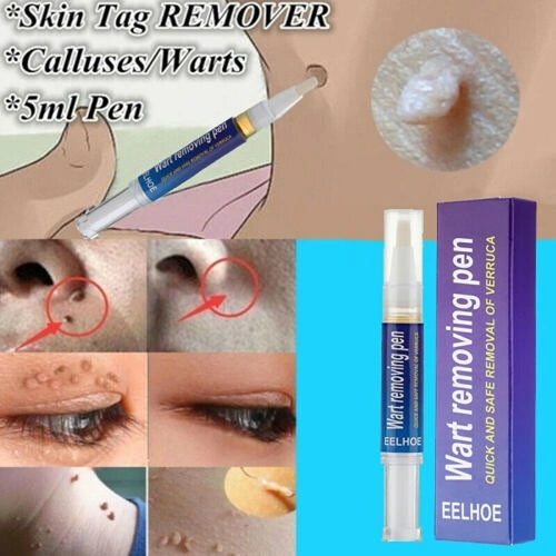 Wart Remover Gel Pen