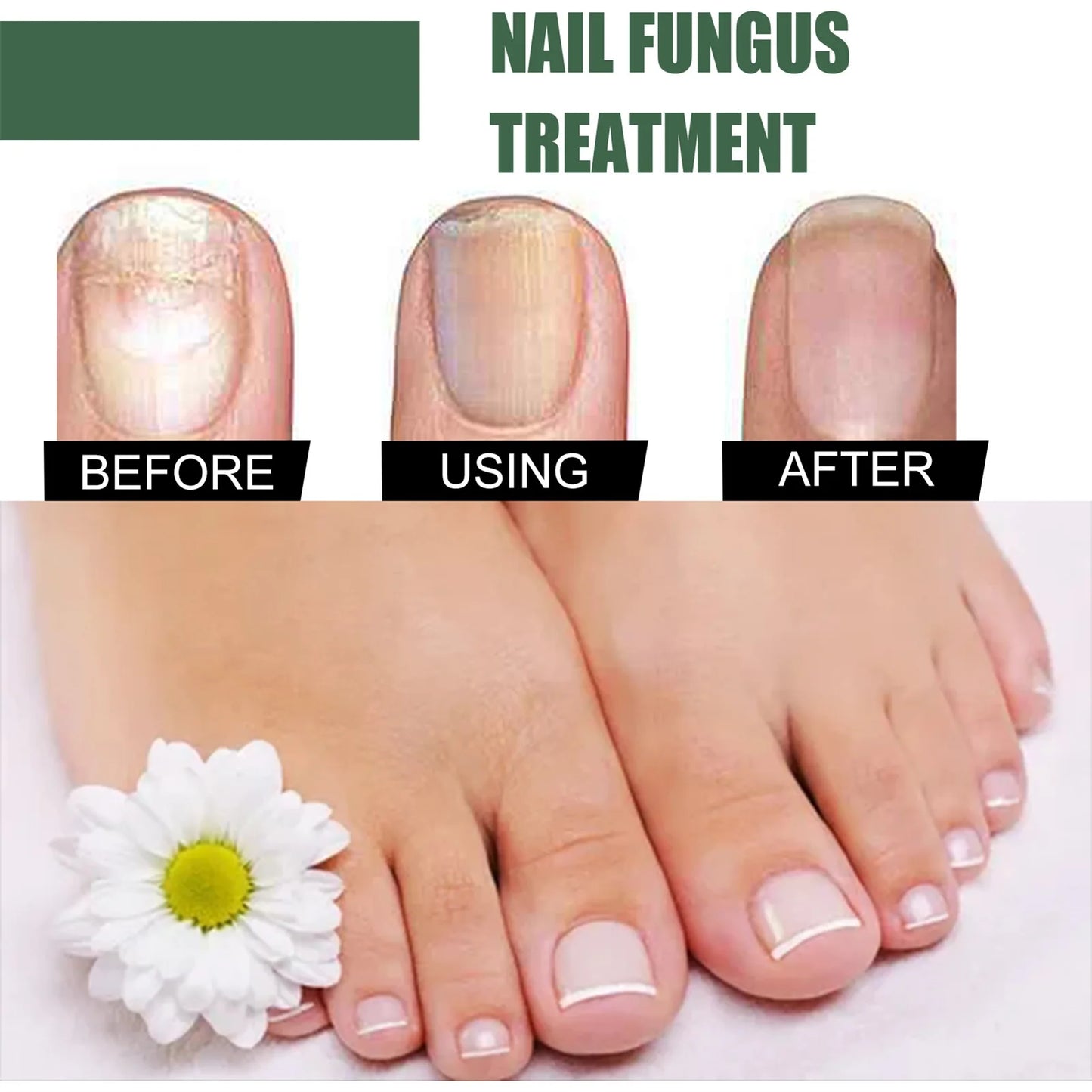 Nail Fungus Serum