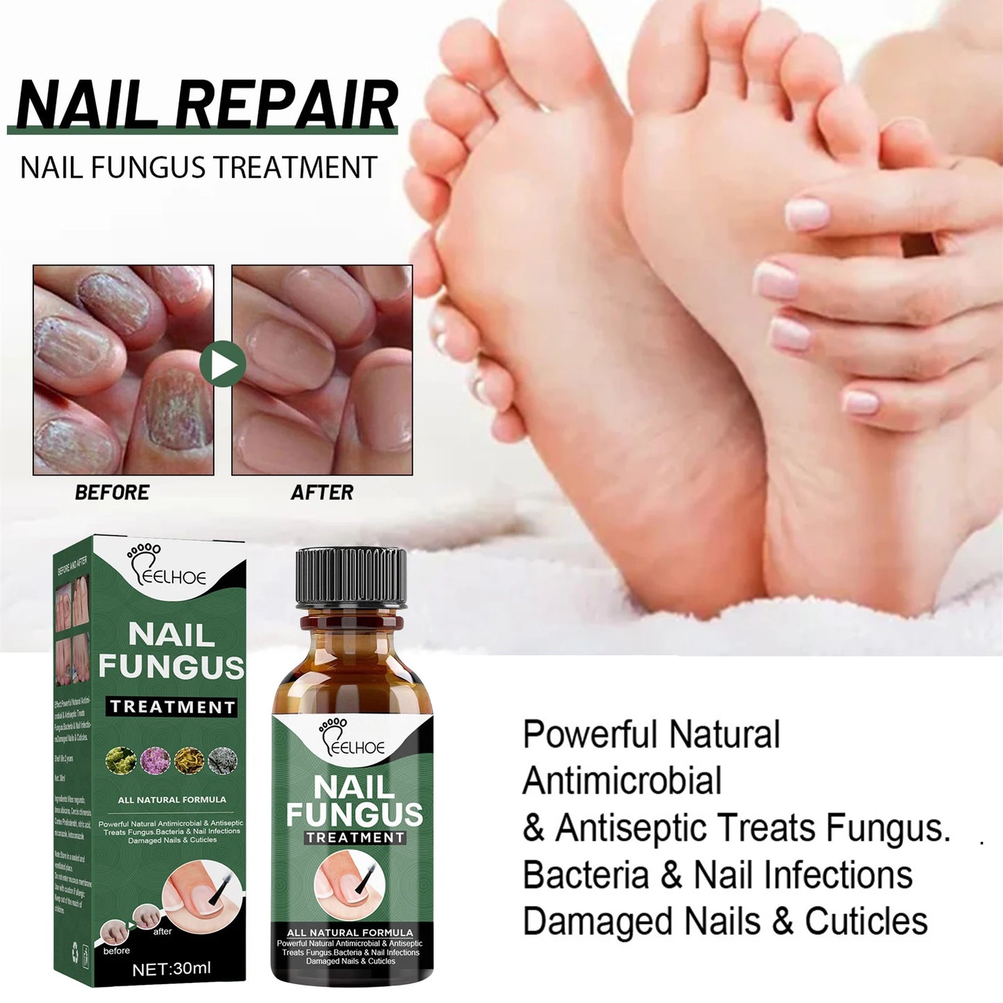 Nail Fungus Serum