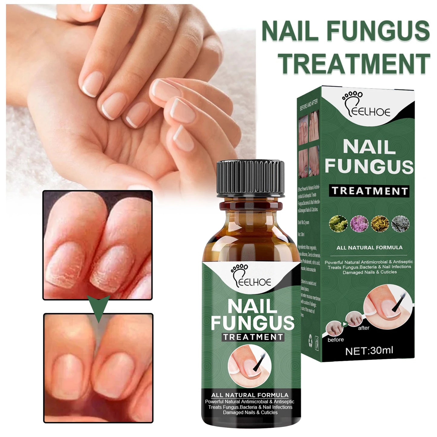 Nail Fungus Serum