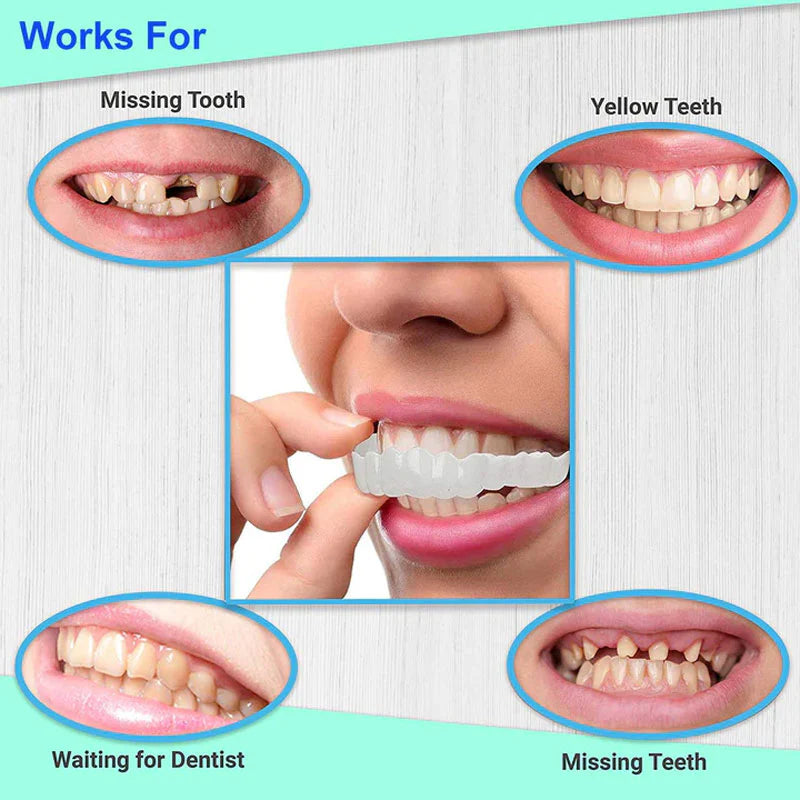 Snap On Braces ( Premium Quality)