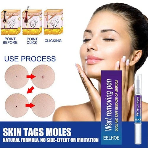 Wart Remover Gel Pen
